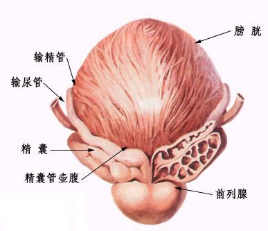 引起前列腺炎原因